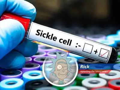 Rick Sanchez from Rick and Morty gives a unique view on recent gene therapies approval for sickle cell disease treatment image